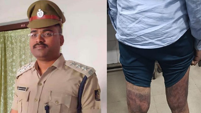 Businessman alleges 2-hour of third degree torture by police