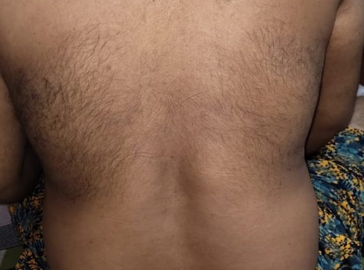 Youth tortured in police custody in Jagatsinghpur