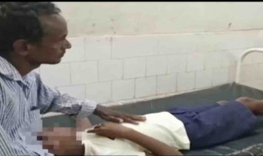 Student critical after being beaten by female teacher in classroom in Odisha