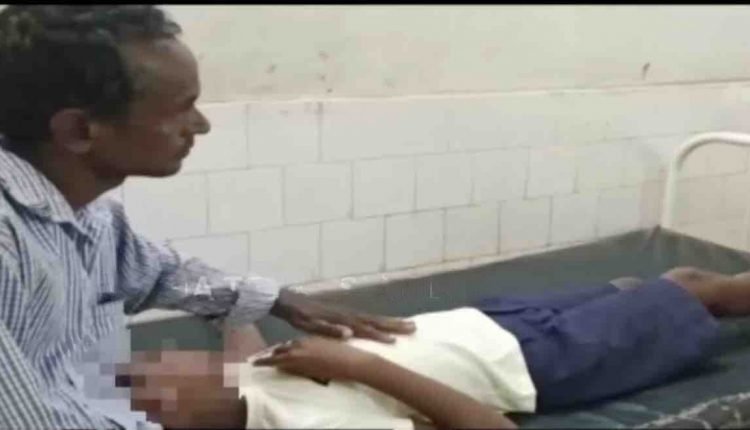 Student critical after being beaten by female teacher in classroom in Odisha