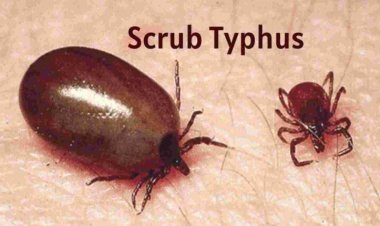 Scrub typhus tally mounts to 193 with 10 fresh cases in Sundargarh