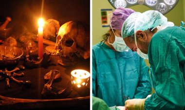 "Doctors in Odisha remove 77 needles from a woman's head; sorcerer arrested."